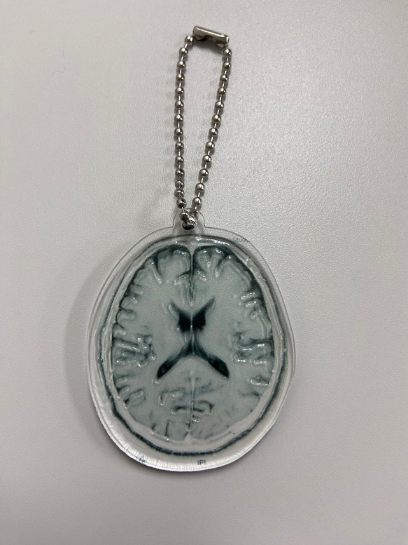 脳レントゲン写真　アクリルキーホルダー 1枚目の画像