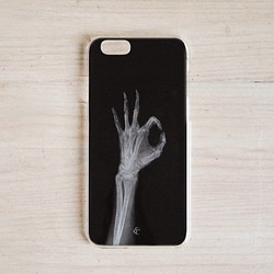 X-ray Phone Case-I&#39;m OK Radiologist iPhone/Samsung/HTC/Sony/ 1枚目の画像